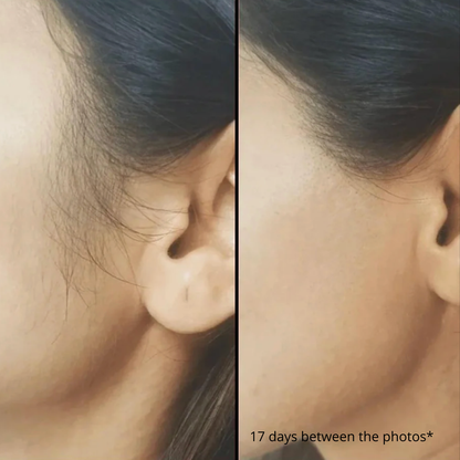 Selfscious SilkaLite IPL Hair Remover™